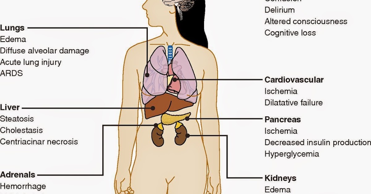 Multi Organ Dysfunction Syndrome ppt. Nursing Path