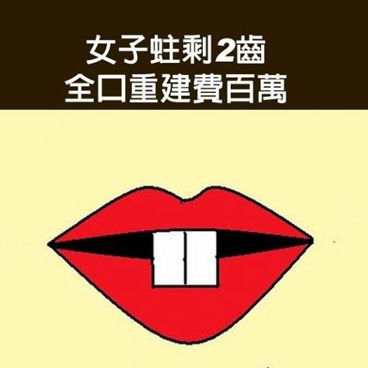 女子蛀剩2齒 全口重建費百萬