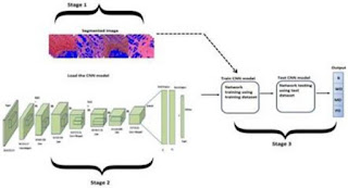 Assam: IASST develops artificial intelligence-based computer diagnosis framework for accurate oral cancer diagnosis