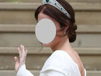 Two Titanium Stems on the Back, Princess Eugenie's Scoliosis Traces Two Titanium Stems on the Back, Princess Eugenie's Scoliosis Traces