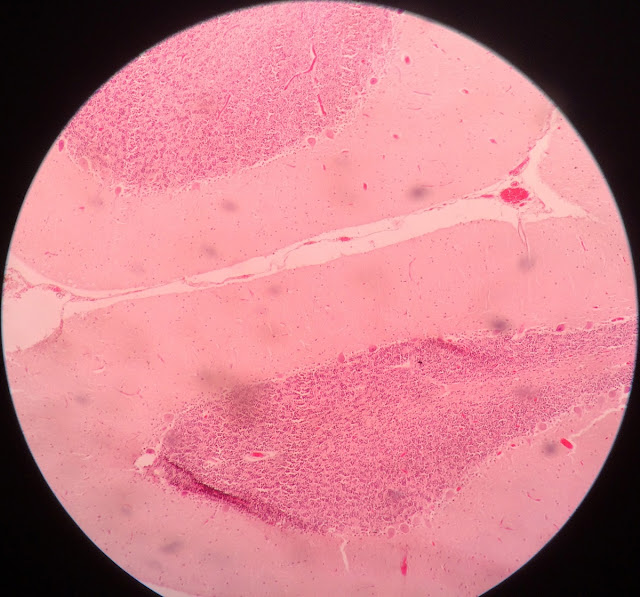 histology slide of cerebellum