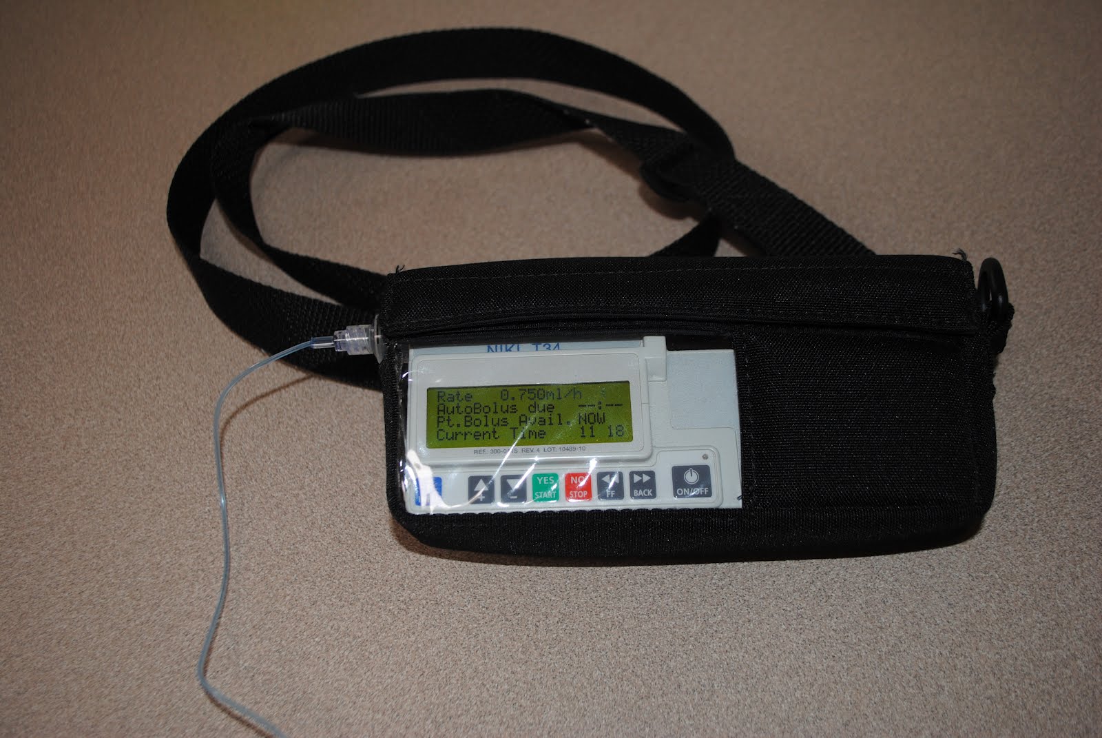 pump zofran carrying case hyperemesis gravidarum syringe sons three fashionable amazingly
