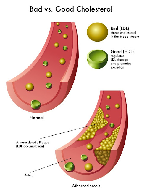 how to improve good cholesterol