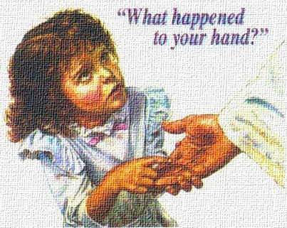 What Happened to YOUR HAND? Seek JESUS CHRIST our RISEN LORD and ask