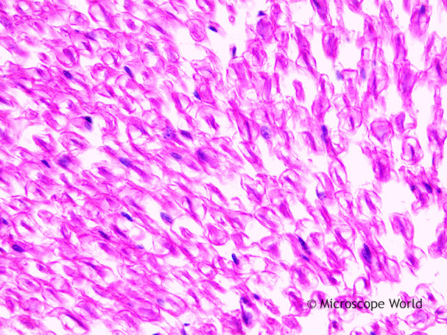 Microscope World image of artery, vein and nerve cross section captured under the microscope at 400x.