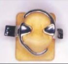 Prótesis Parcial Removible (PPR)