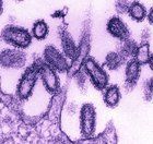 Vibrio Cholerae Bacteria may be Causing Cholera