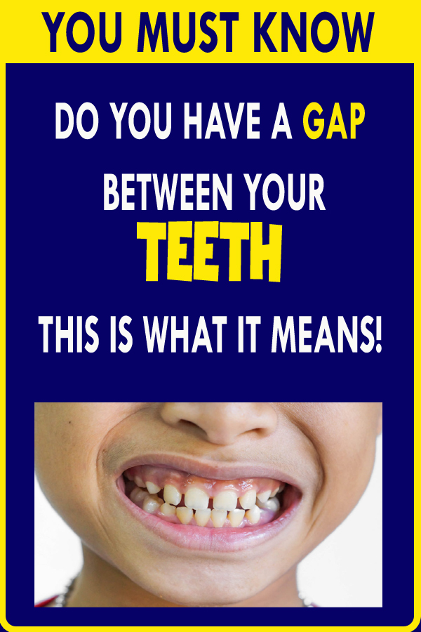 DO YOU HAVE A GAP BETWEEN YOUR TEETH THIS IS WHAT IT MEANS!