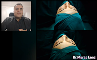 Dr.Murat Enoz - Hospital Selection For Rhinoplasty, Anesthesia - Sterilization Conditions and Importance of Materials