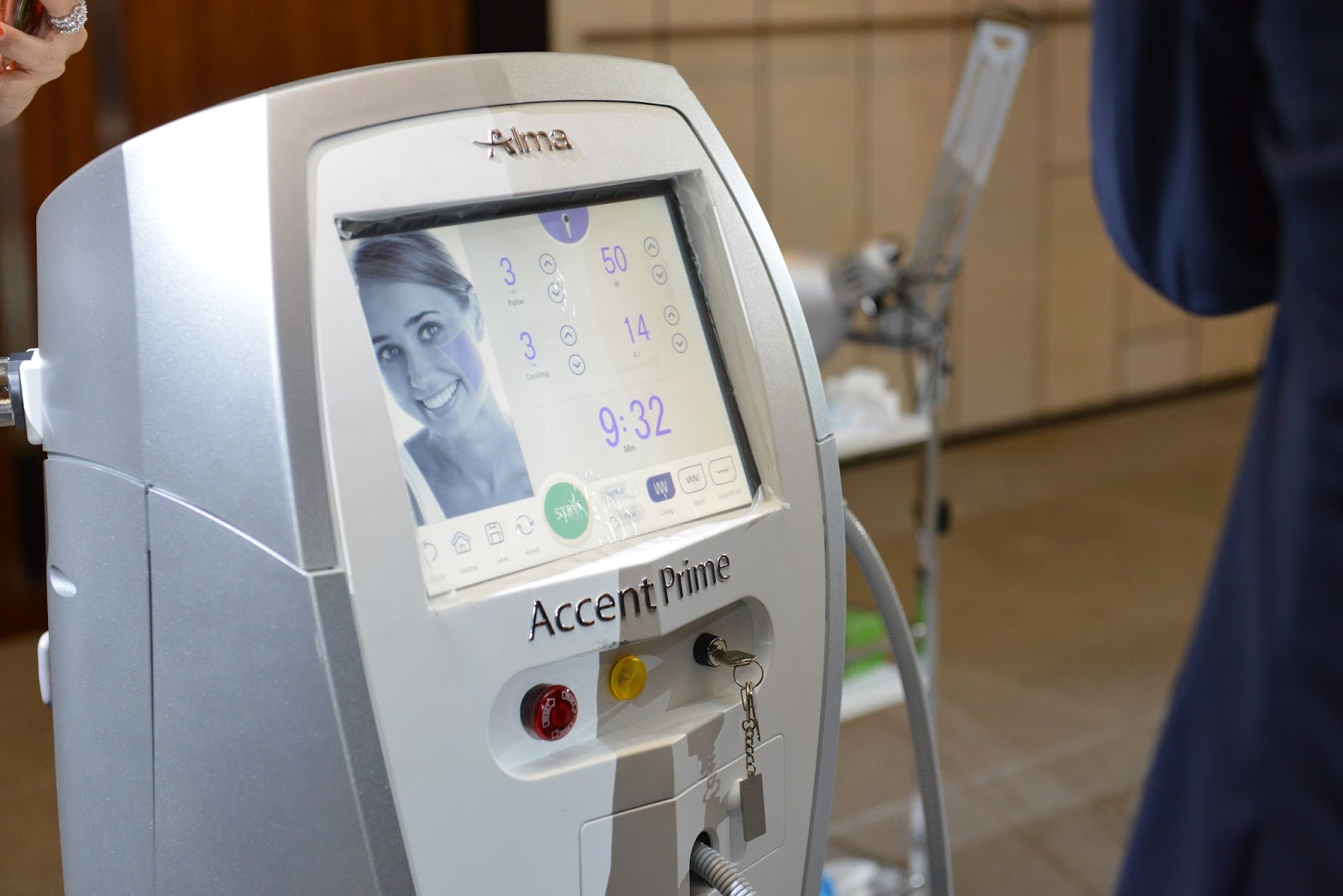Alma Laser launched Accent Prime, a CuttingEdge Platform which Doubles