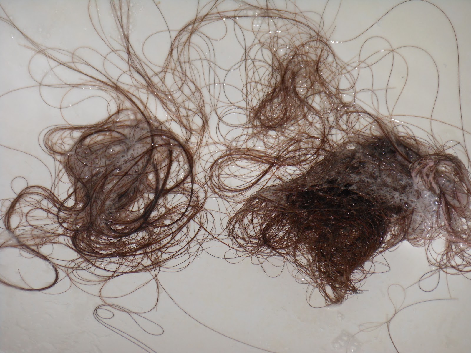 Pousse De Cheveux Rapide Et Naturelle Perte De Cheveux A Cause De