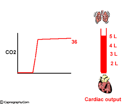 CAPNOGRAPHY TRONG GÂY MÊ Ở NGƯỜI LỚN