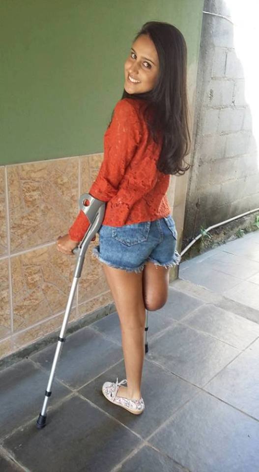 Beautiful girls amputee with crutches : - Amputee girls