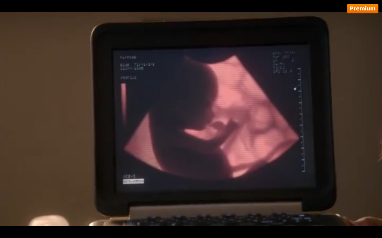 Extant Episodes 7 Thru 8 Recaps: Be On The Lookout For An Escaped Alien ...