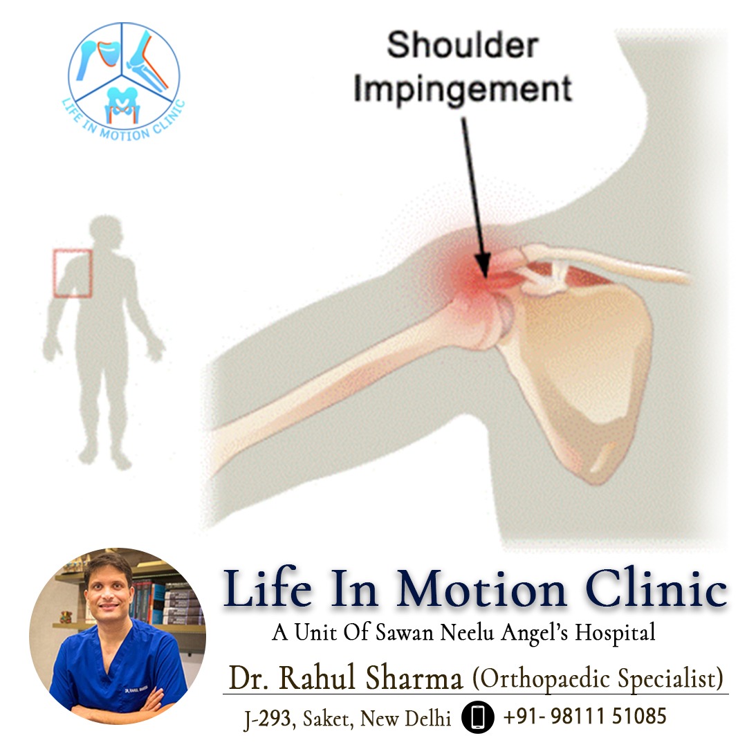 Shoulder Pain Due to Bursitis