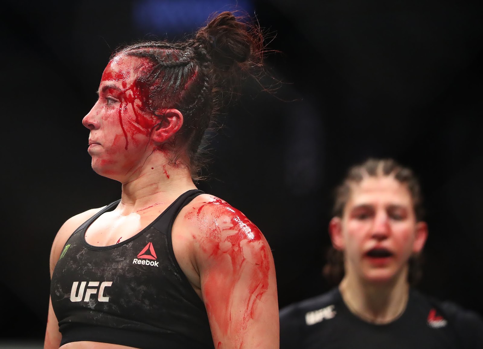 Maycee Barber Suffered Complete ACL Tear Against Roxanne Modafferi.