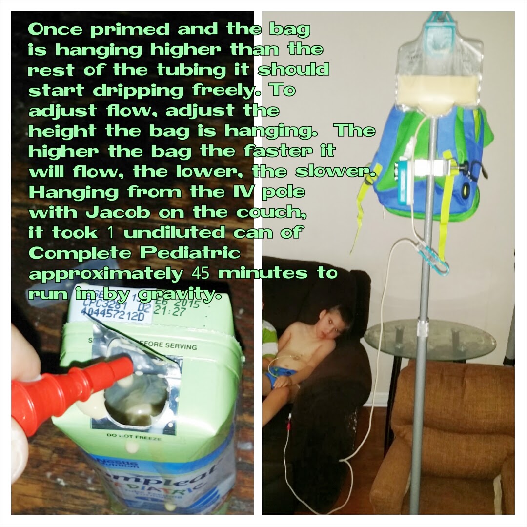 Spastic Quadriplegic Cerebral Palsy How to Convert Zevex Infinity Pump