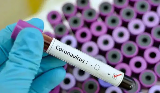 Covid-19 Vaccine, Coronavirus test