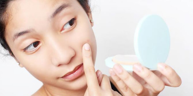 5 TIPS AMPUH : Cegah Muncul Jerawat pada Anak. 5 TIPS AMPUH : Cegah Muncul Jerawat pada Anak.