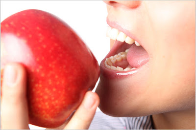 Apples for teeth whitening