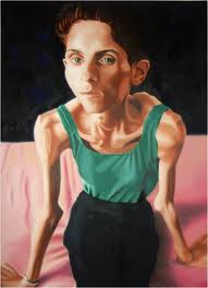 Kate Chilver Anorexia