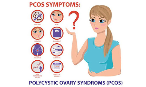 Symptoms Of PCOS