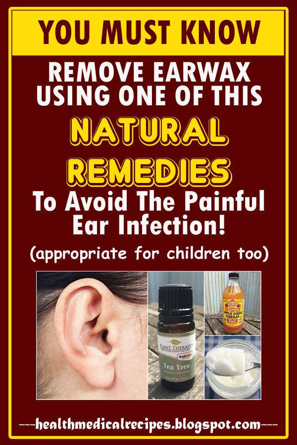 Get Rid Of The Wax In Your Ears With These Natural Remediese