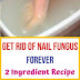 Get Rid Of Nail Fungus Forever – 2 Ingredient Recipe 
