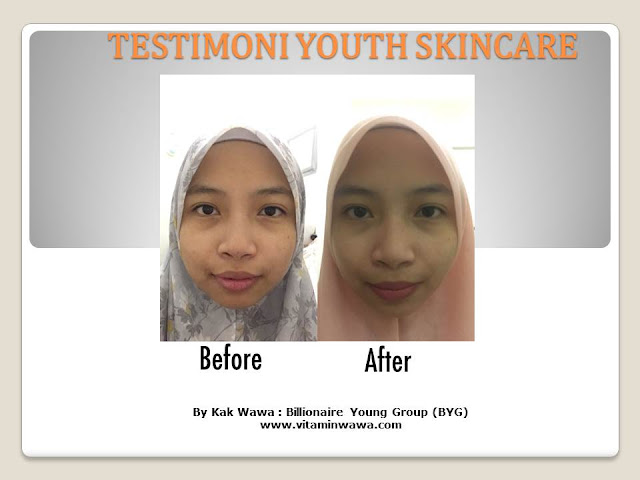 34 Testimoni Youth Skincare Shaklee Terbaru, Youth skincare shaklee, testimoni youth skincare shaklee, Youth Skincare Shaklee : Harga dan Review Pengguna Youth Shaklee, testimoni youth skincare shaklee, testimoni youth skincare shaklee 34 Testimoni Youth Skincare Shaklee Terbaru, Youth skincare shaklee, testimoni youth skincare shaklee, Youth Skincare Shaklee : Harga dan Review Pengguna Youth Shaklee, testimoni youth skincare shaklee, testimoni youth skincare shaklee
