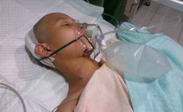WASPADA!! Gejala Tumor Otak ini Sering Disepelehkan karena Orang Tidak Tahu WASPADA!! Gejala Tumor Otak ini Sering Disepelehkan karena Orang Tidak Tahu