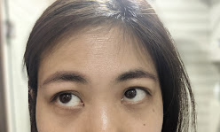 wrinkles and dark circles