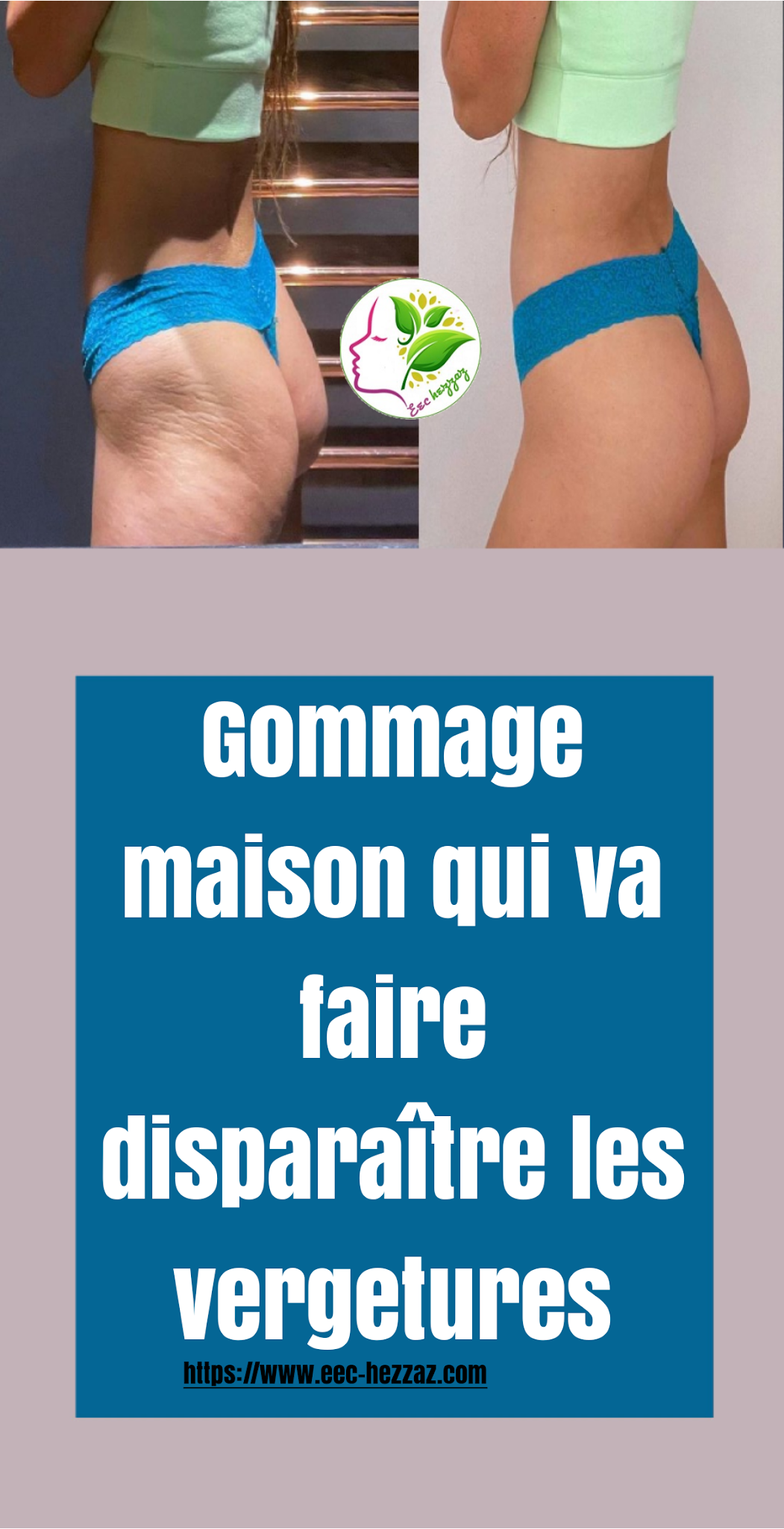 Gommage maison qui va faire disparaître les vergetures