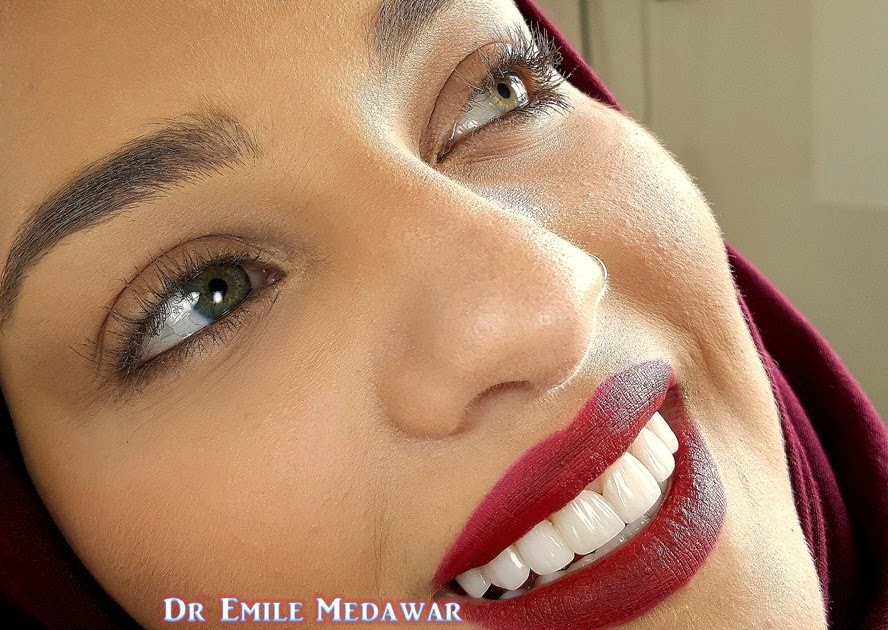 Dentist Emile Medawar, Veneer Qatar