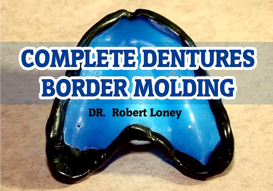 COMPLETE DENTURES Border Molding Robert Loney OdontoTv