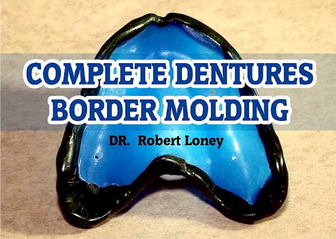 COMPLETE DENTURES: Border Molding -  Robert Loney