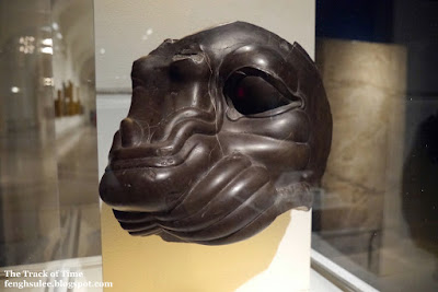 頭頸部がんと早期診断の重要性