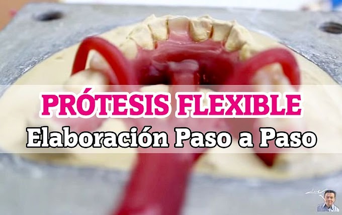 PRÓTESIS FLEXIBLE Paso a Paso - CD - TPD Daniel Ávila