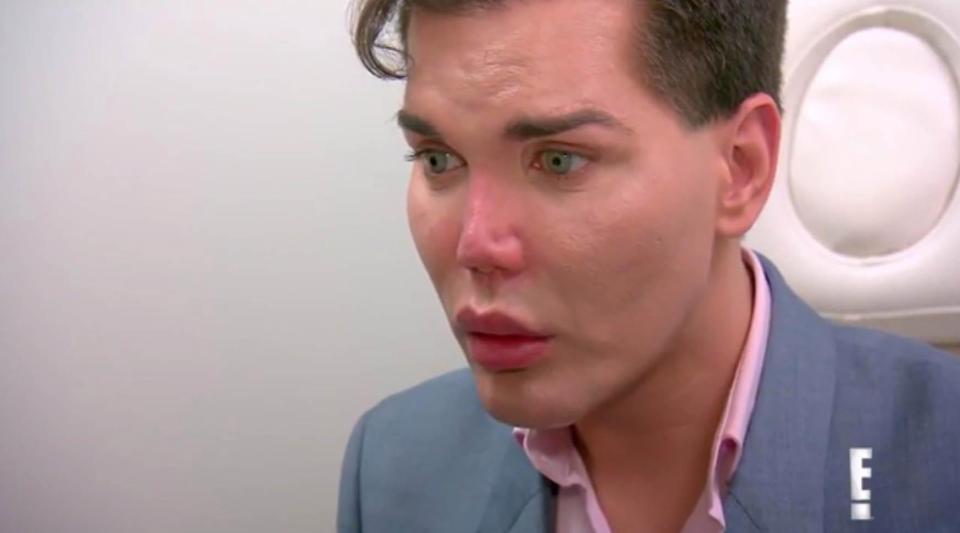 SURGERY SHOCK‘Human Ken Doll’ Rodrigo Alves is warned his nose could