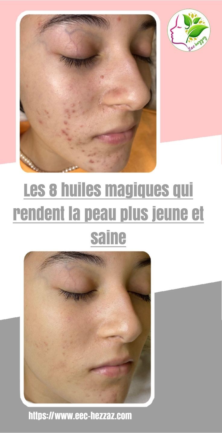 Les 8 huiles magiques qui rendent la peau plus jeune et saine