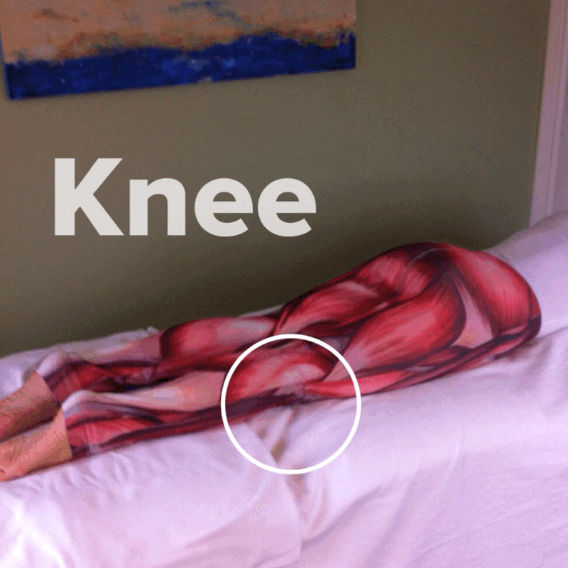 The Hip Joint: 1 of 3 Hamstrings: Biceps Femoris