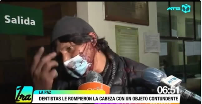 Dos dentistas rompen la cabeza con nunchaku a padre que reclamó por su hijo