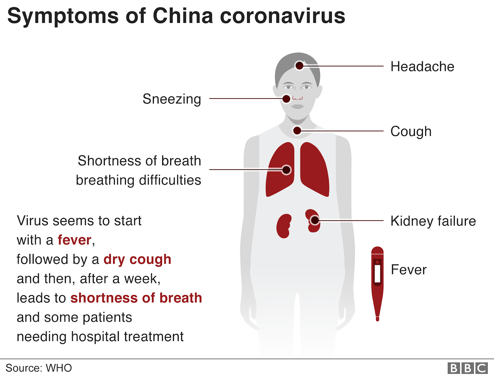 Основные симптомы коронавируса инфекции. Признаки короноваоису. Признаки клрооовирусп. Признаки короны. Легкая форма вируса