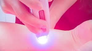 Home laser hair removal methods