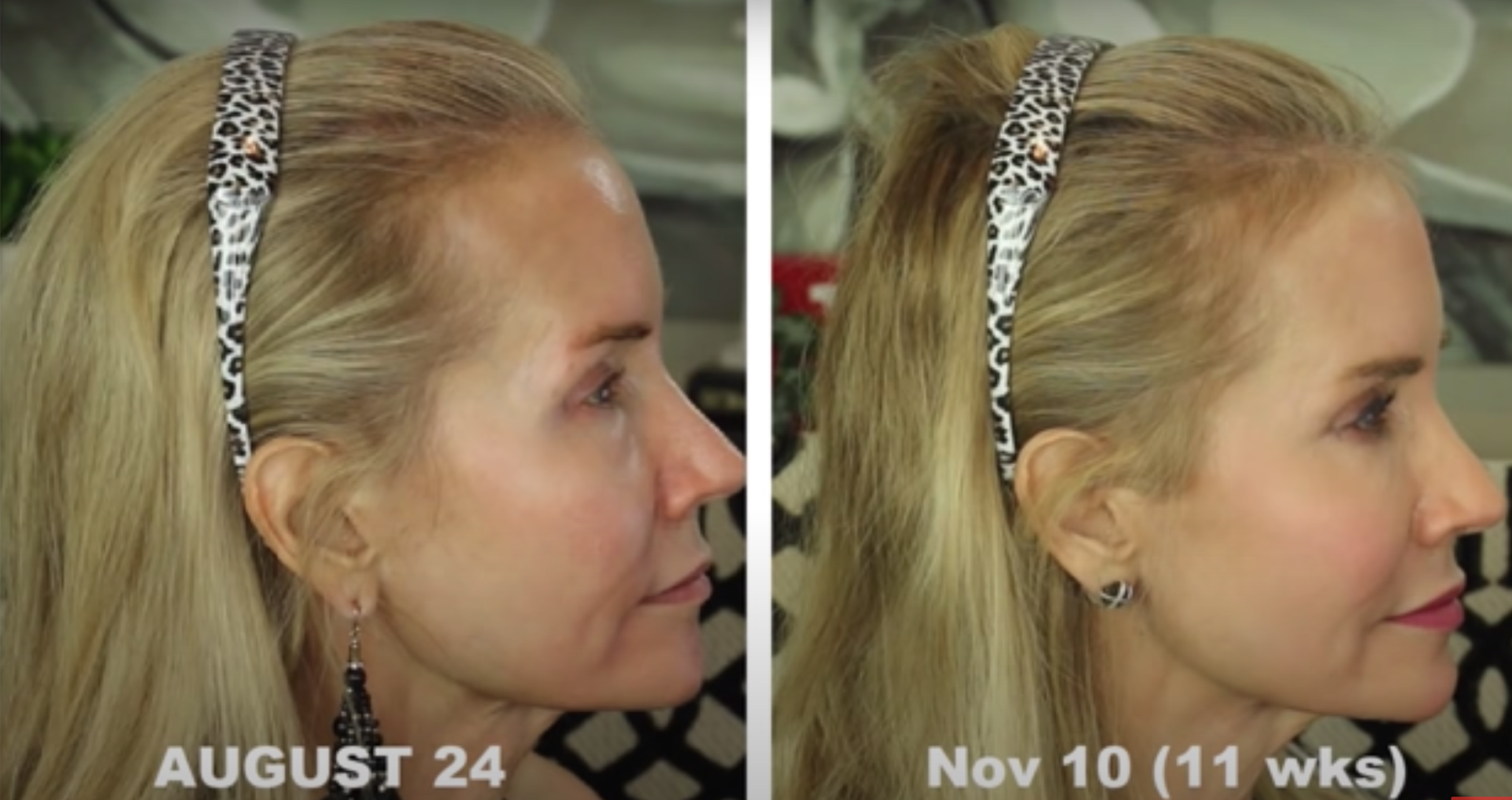 You Need to be using a Red Light Therapy Panel at Home. Here's Why