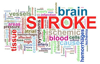 Askep Penyakit Stroke Pada Lansia, Tip Mengobati Stroke, Pengobatan Stroke Di Jogja, Penyakit Stroke Perdarahan, Terapi Penyakit Stroke, Penyakit Stroke Telinga, Obat Tradisional Penyakit Stroke Ringan, Cara Pengobatan Stroke Iskemik, Obat Sakit Stroke Sebelah Kanan, Ramuan Untuk Mengobati Penyakit Stroke, Pengobatan Stroke Panggilan, Cara Mengobati Stroke Dengan Herbal, Pengobatan Penyakit Stroke Ringan, Penyakit Stroke Dan Cara Pencegahannya, Pengobatan Stroke Akibat Diabetes 