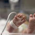 [Κόσμος]Αλβανία:Πήγε στο νοσοκομείο για σκωληκοειδίτιδα  ...και έφυγε με το δεύτερο παιδί της!