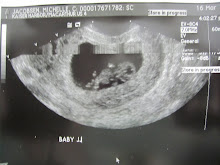 Baby JJ's 9.5 Week Ultrasound