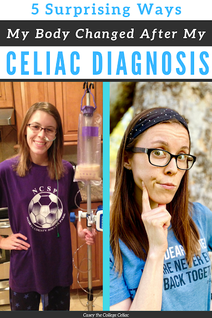 More changes with a #celiacdisease diagnosis than going #glutenfree. #Celiac can also change your body in some surprising ways!  #chronicillness #gf
