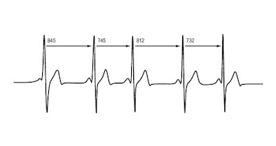 HRV Heart Rate Variability