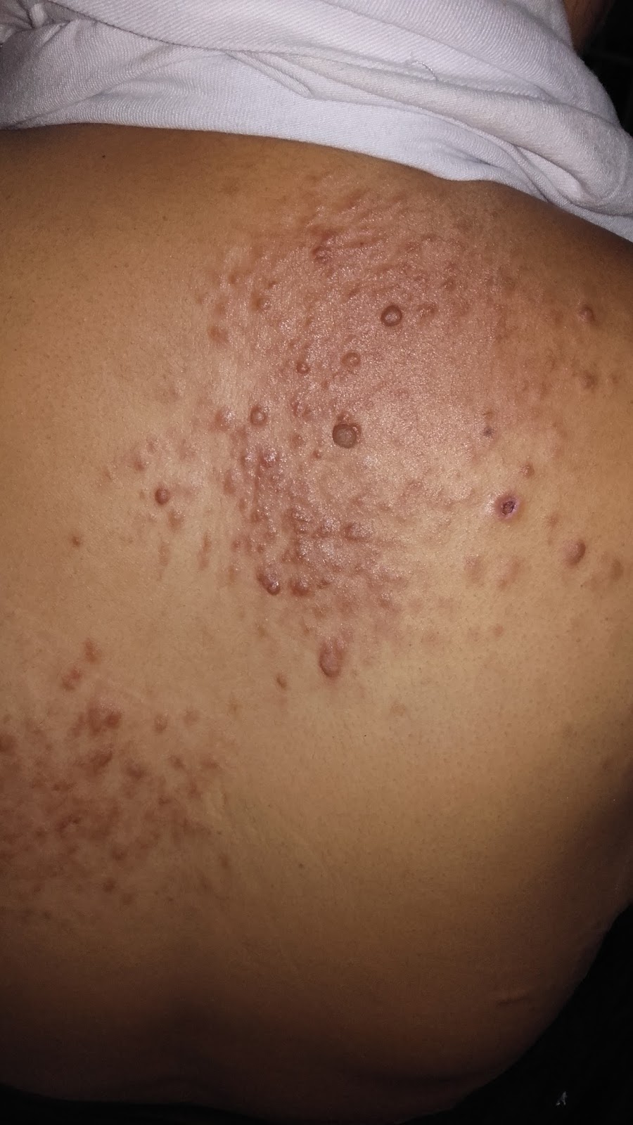 Journal of Postgraduate Gynecology & Obstetrics May 2016 Journal of Postgraduate Gynecology & Obstetrics May 2016